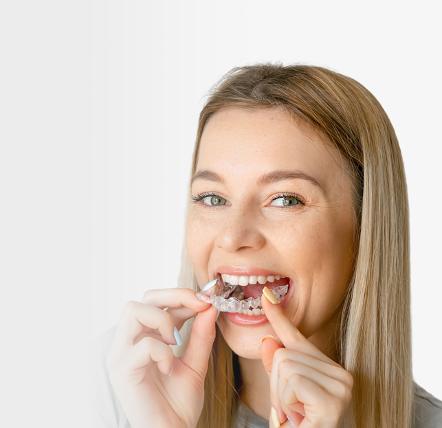  Who is a candidate for Angel Aligners?