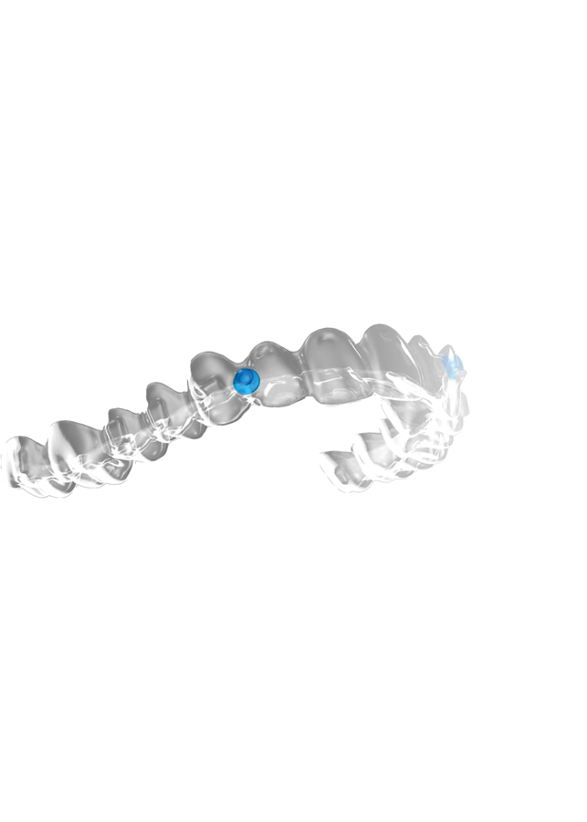  Benefits of Angel Aligners